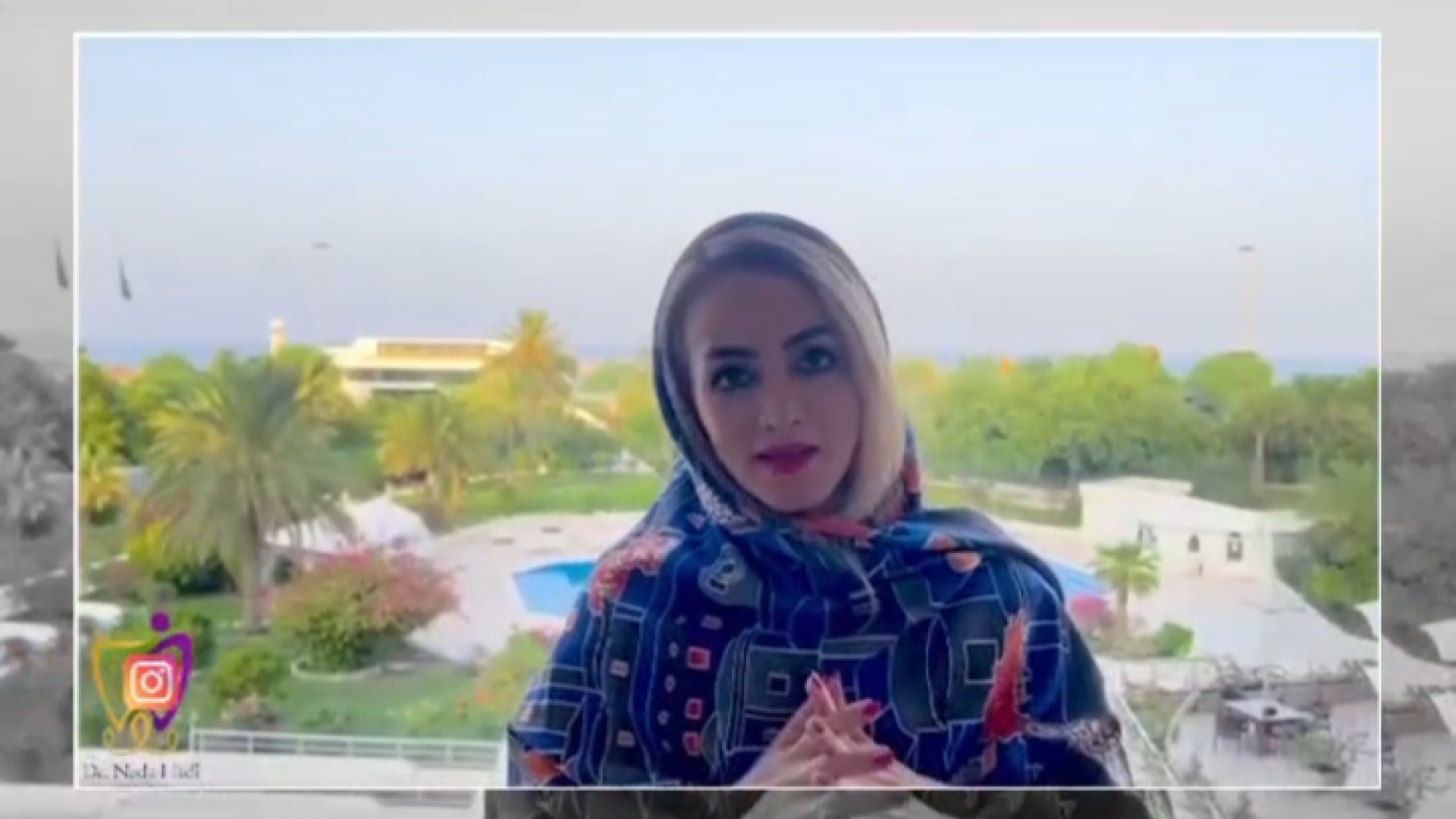 تحلیل لثه دکتر ندا هادی-دندانپزشک زیبایی