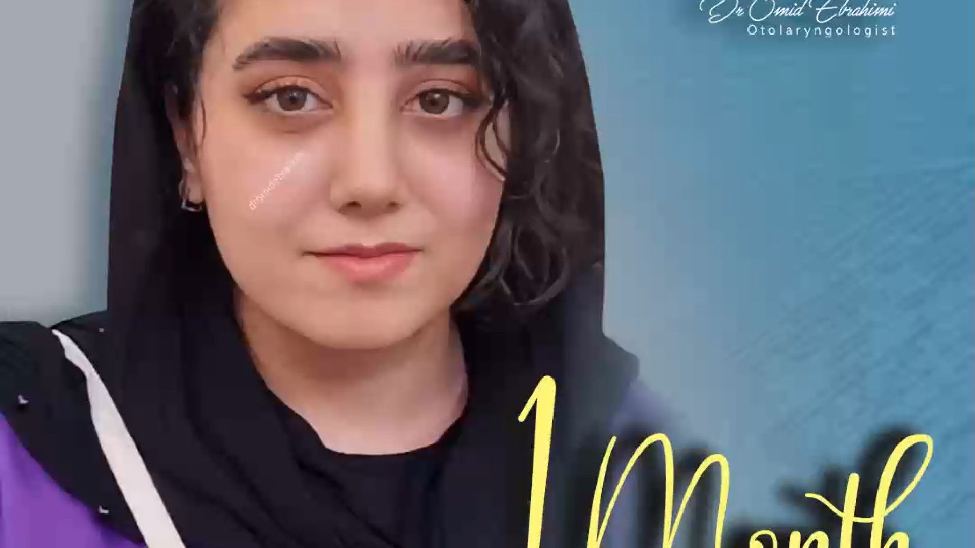 رضایتمندی بعد از عمل بینی توسط دکتر امید ابراهیمی دکتر امید ابراهیمی