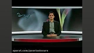 دکتر احمد عدنان در مورد پسوریازیس می گوید کیانو ریوز