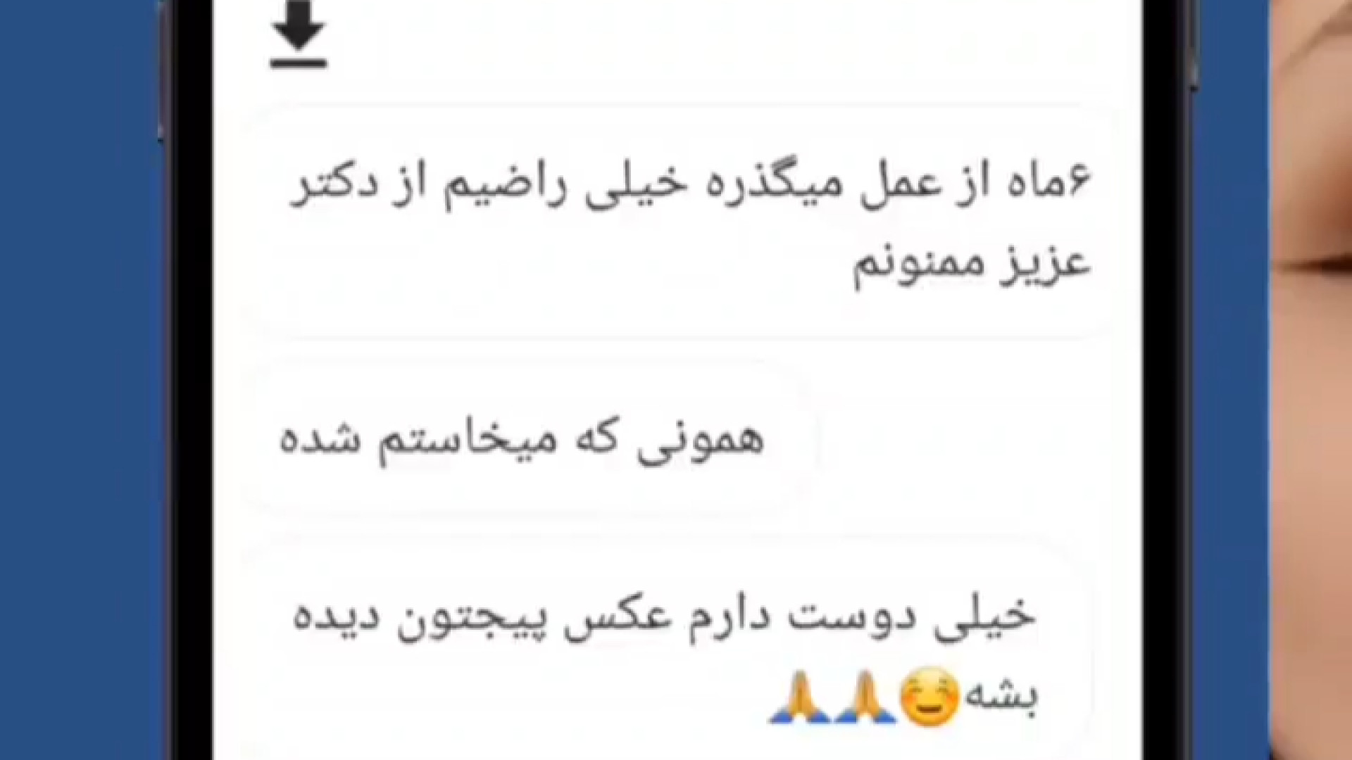 رضایت از رینوپلاستی | دکتر علی واجاری دکتر علی حسینی واجاری - جراح بینی رشت