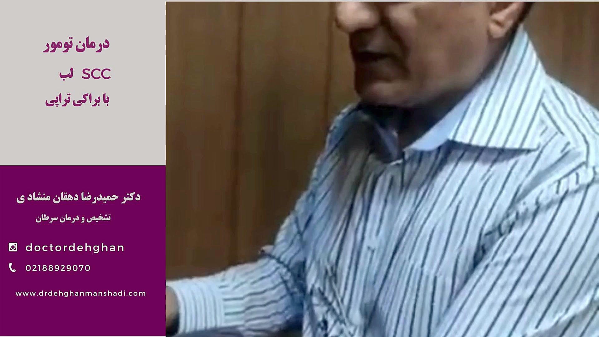 براکی تراپی SCC لب دکتر حمیدرضا دهقان منشادی