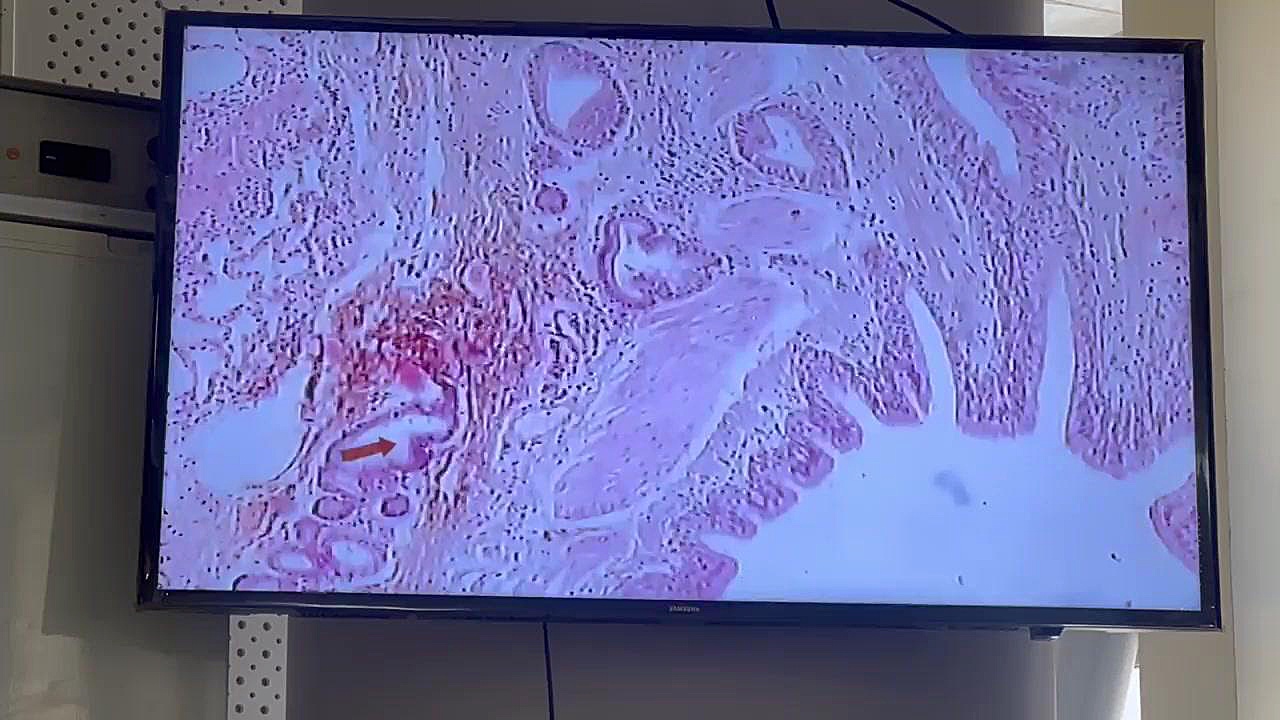 لام۳ ج۵ دکتر عینی مزوتراپی