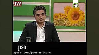 آیا پسوریازیس در حال حاضر درمان قطعی دارد؟ پست جدید