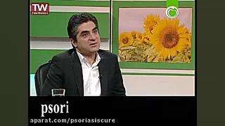 پسوریازیس ناخن و علایم مختلف آن دماغ آلبالویی