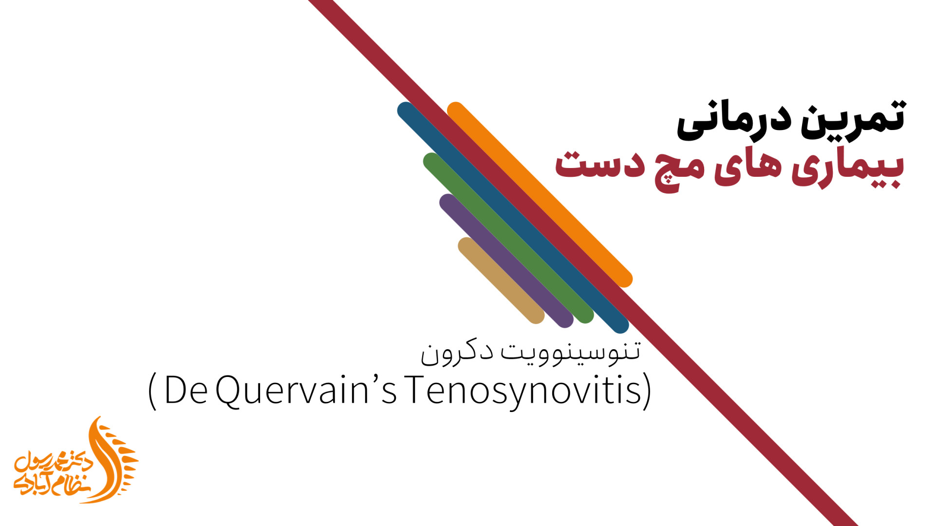 درمان تنوسینوویت دکرون با تمرینات ورزشی دکتر محمد رسول نظام آبادی (فلوشیپ ستون فقرات)