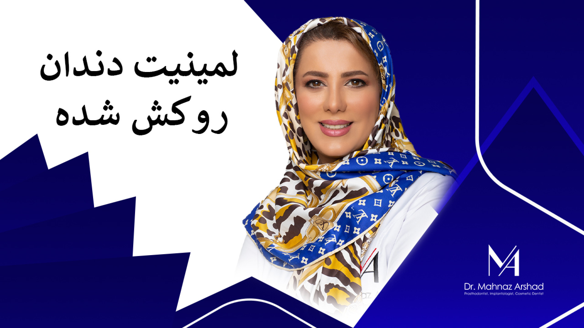 لمینیت دندان روکش شده دکتر مهناز ارشد