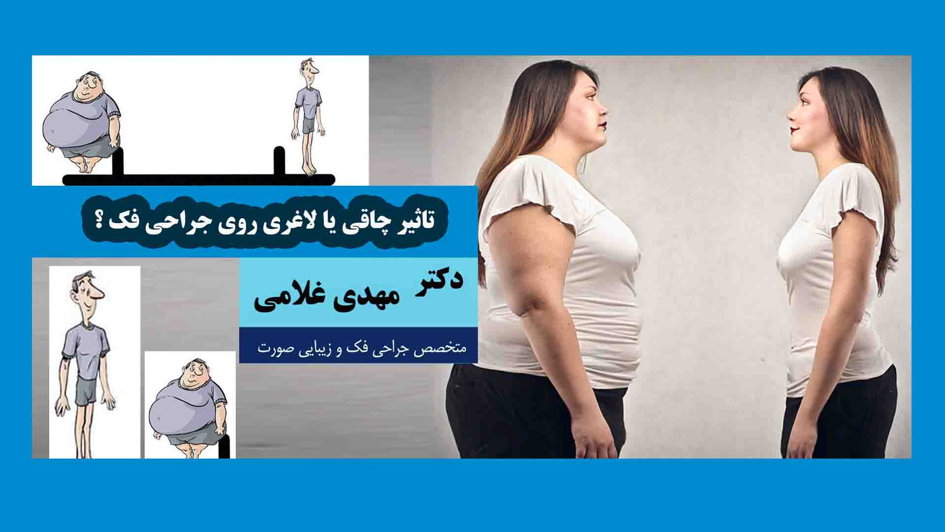 تاثیر چاقی یا لاغری روی جراحی فک زیبایی پوست