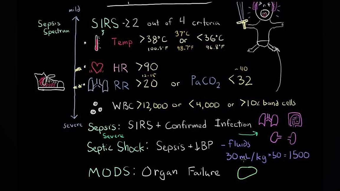 سپسیس- سندرم پاسخ التهابی سیستمیک (SIRS) به سندرم اختلال عملکرد ارگان های متعدد کولفی‌تیل