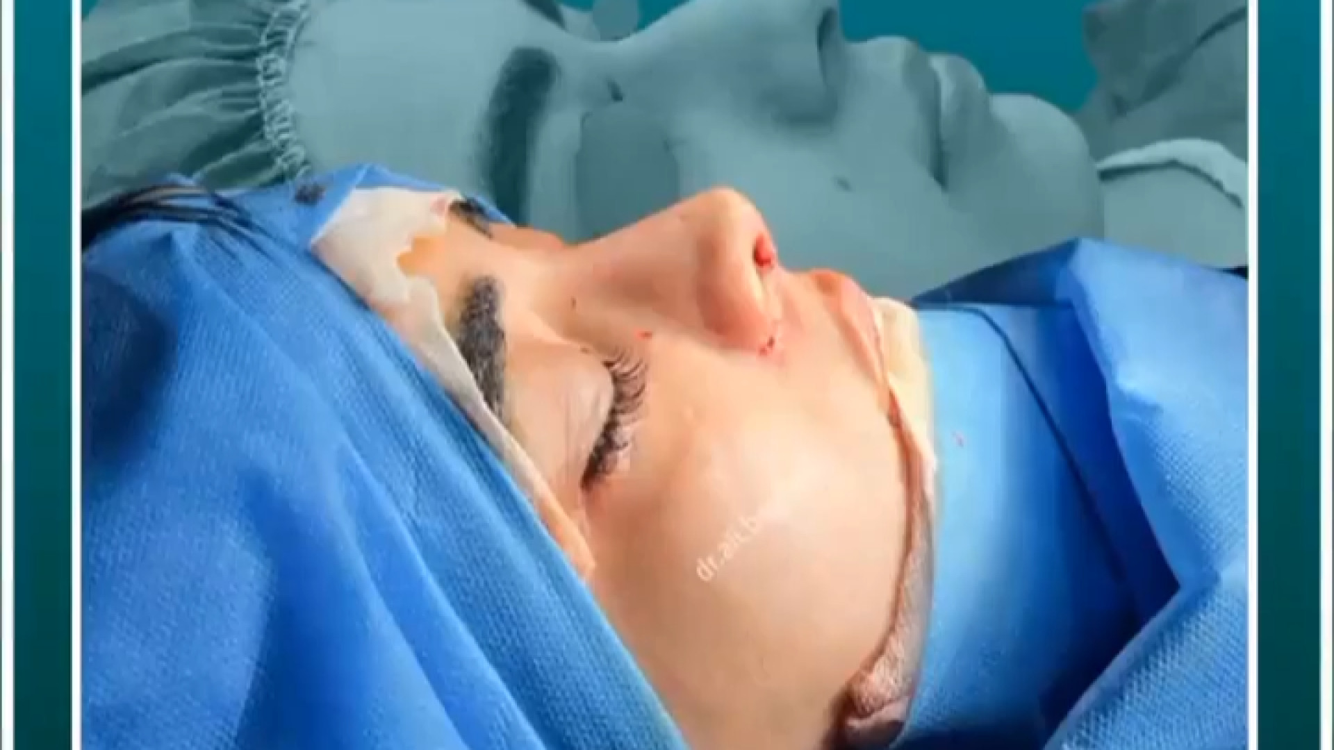 بلافاصله بعد از عمل | دکتر باقری حق دکتر علی باقری حق