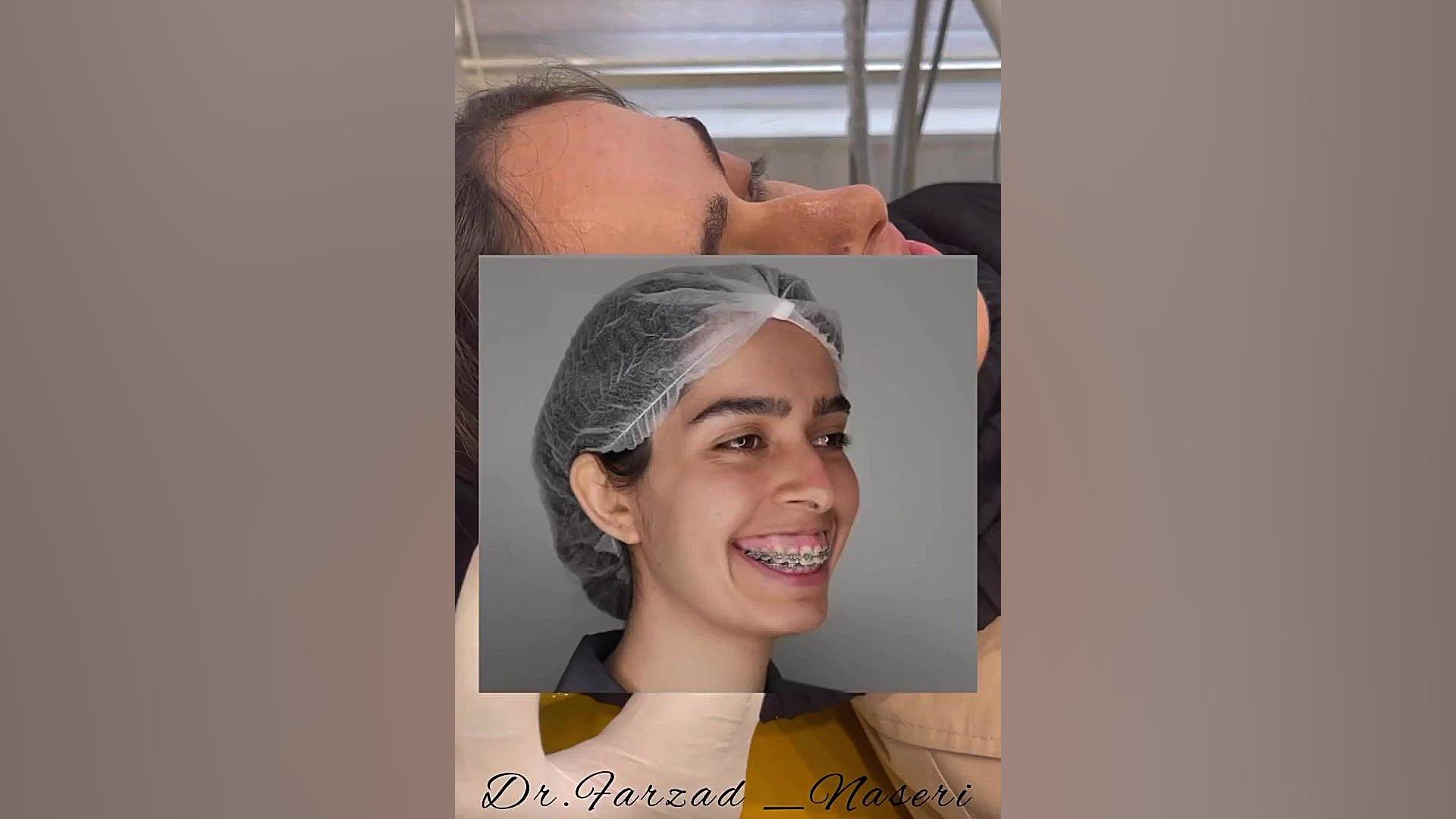 ارتودنسی بعد از انجام جراحی فک دکتر فرزاد ناصری متخصص ارتودنسی در اصفهان