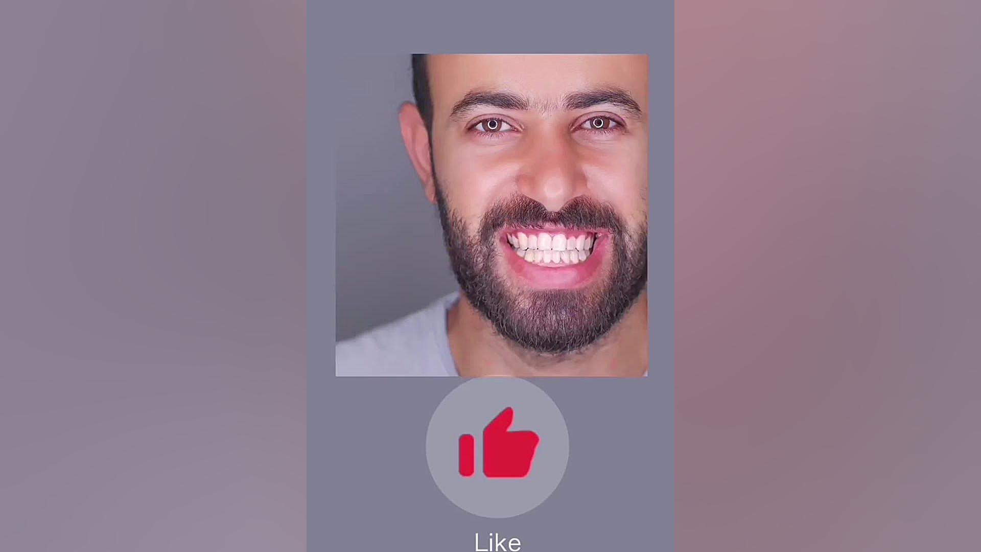 قبل و بعد ارتودنسی دندان دکتر فرزاد ناصری متخصص ارتودنسی در اصفهان