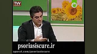 روش های درمان و مراقبت از پسوریازیس ناخن ریحانا