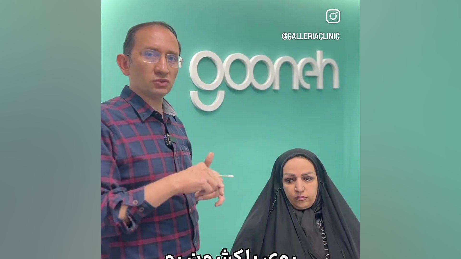 جراحی افتادگی پلک کاندسارتان