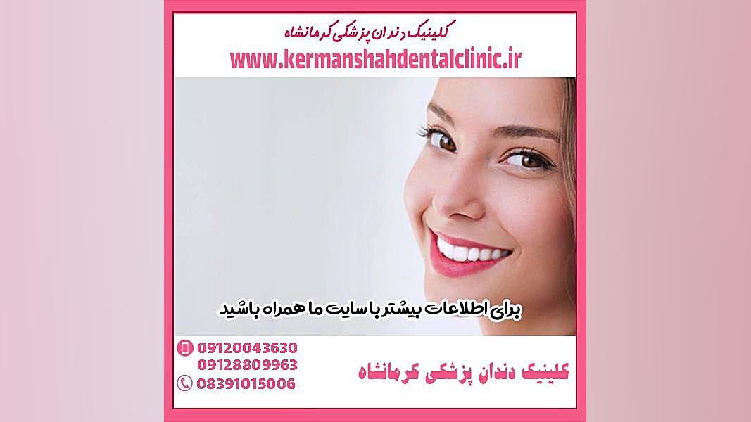 سفید کردن دندان با بلیچینگ پلاستیک لثه
