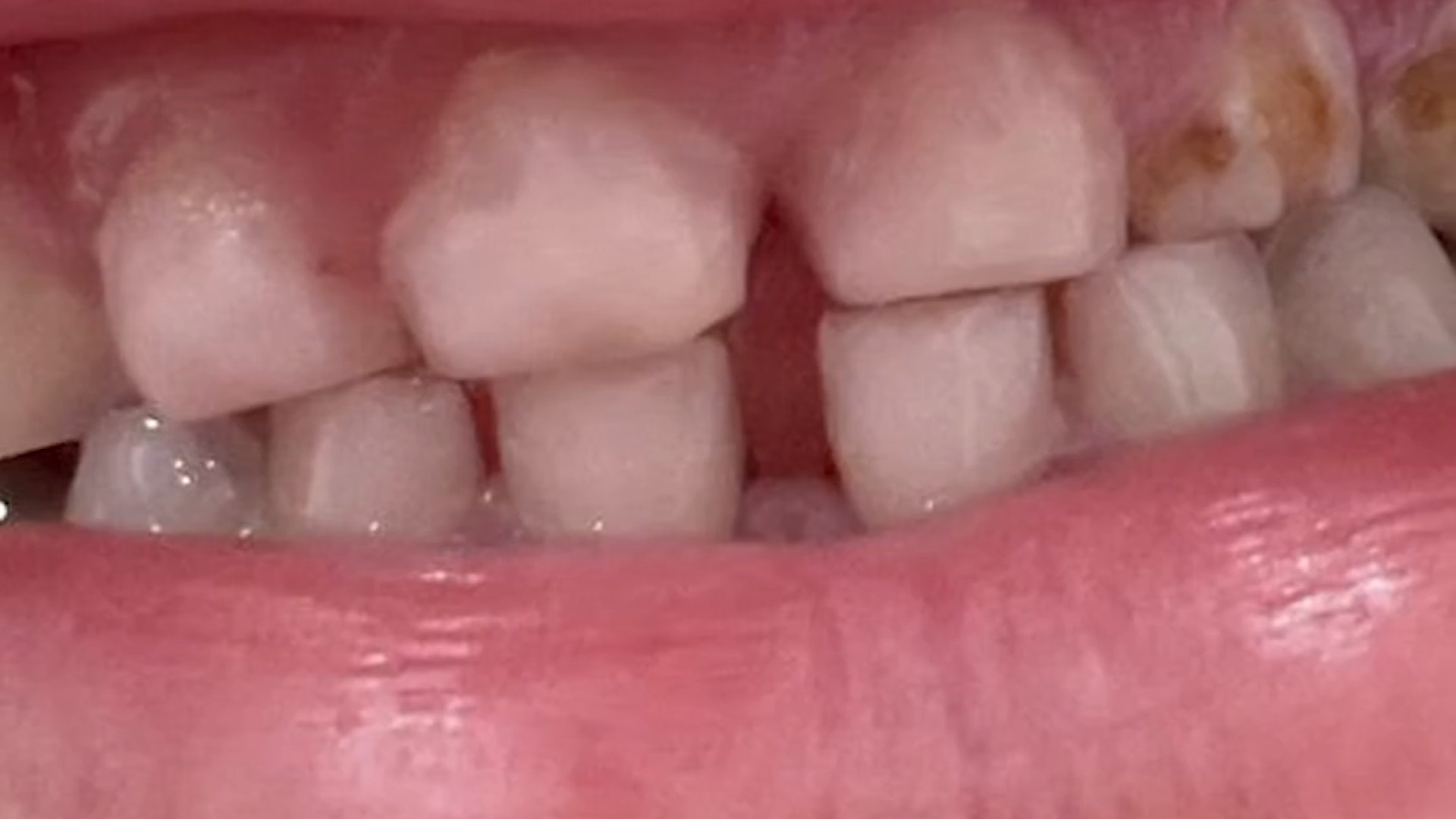 رسیدگی به دندان کودکان دکتر آزاده فاضل _ دندان پزشک کودکان