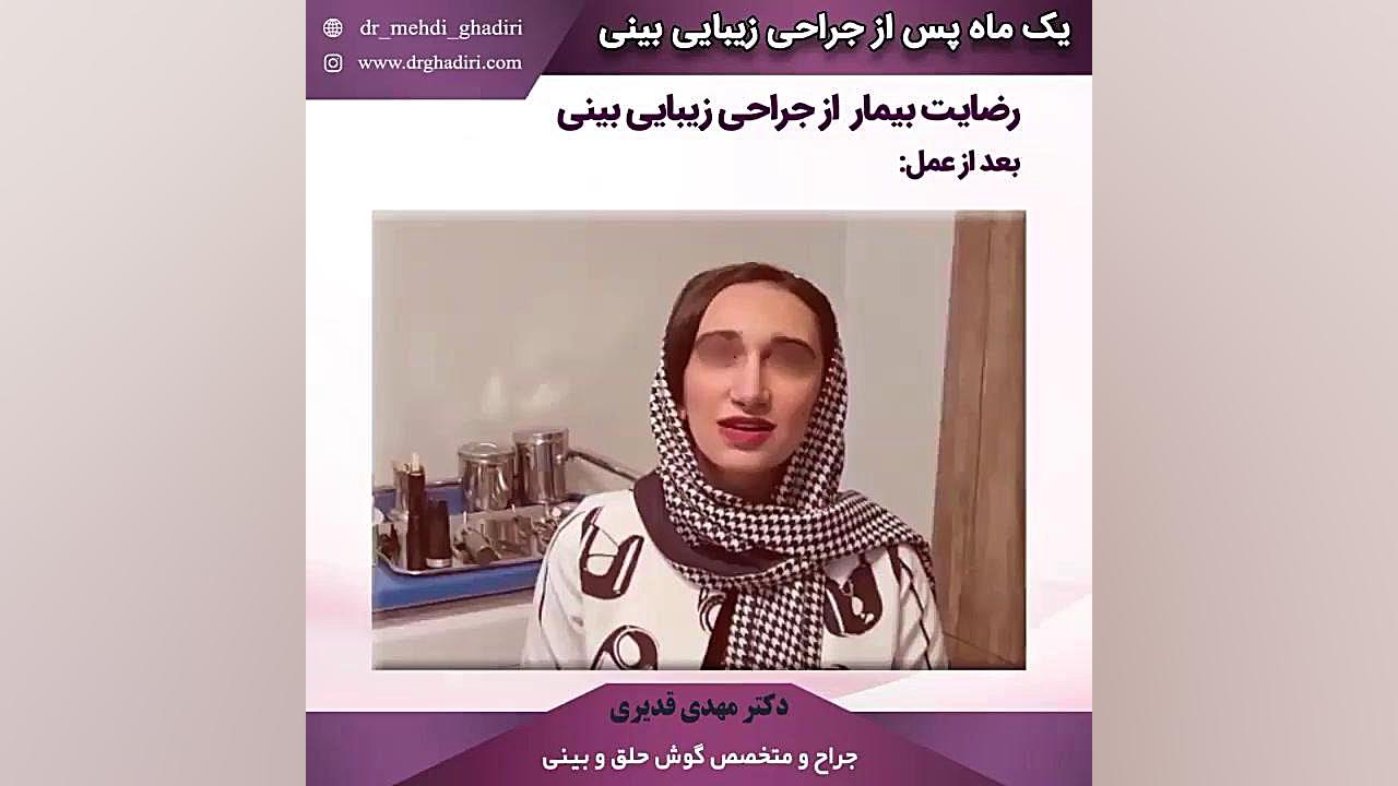 رضایت بیمار از عمل بینی دکتر مهدی قدیری