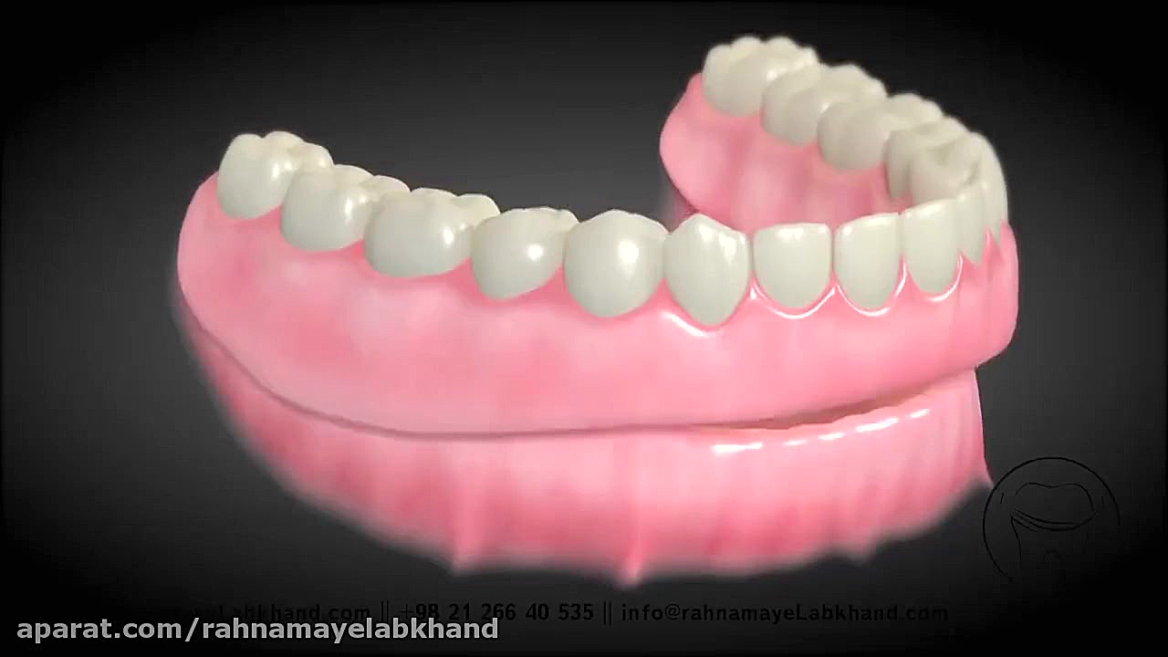 دندان مصنوعی لمینت