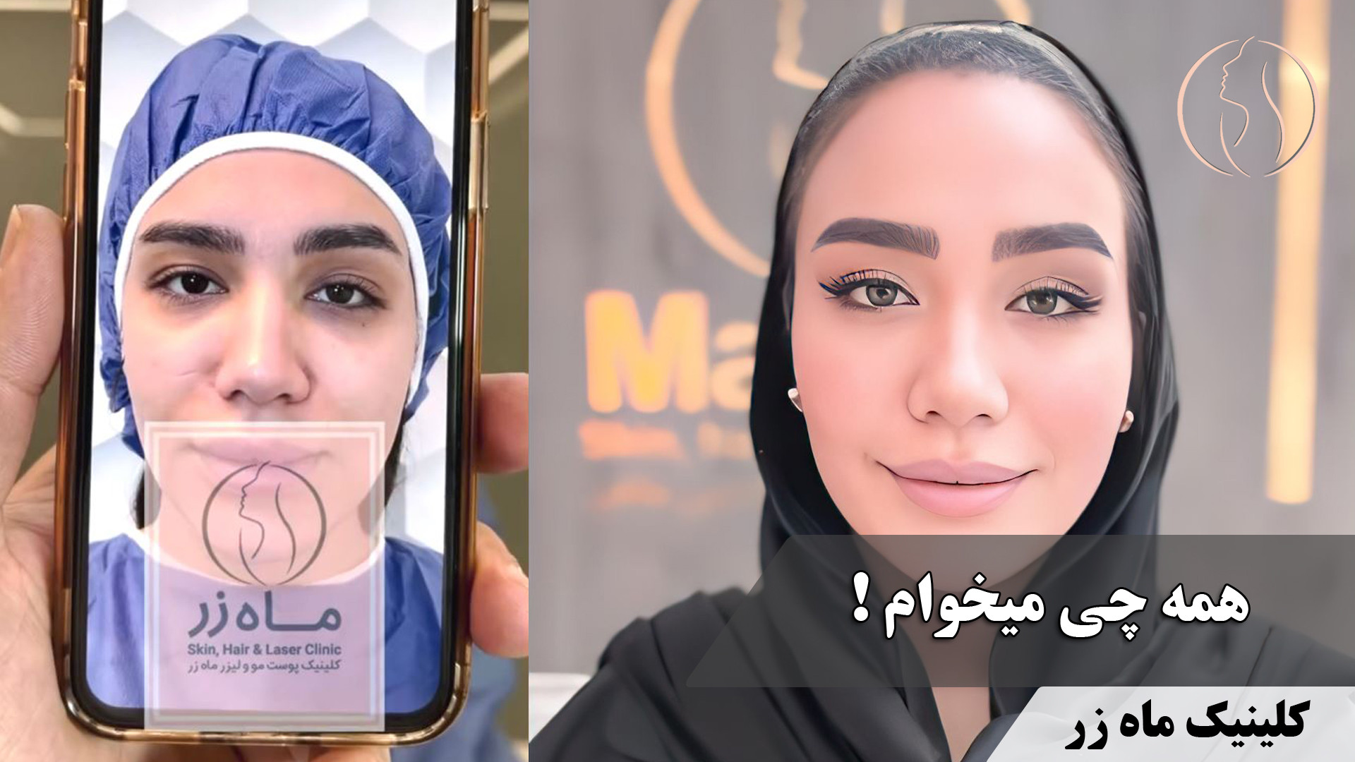 توی چهره کدوم عضو مهمتره؟! ( کلینیک زیبایی ماه زر ) گالکانی زوماب