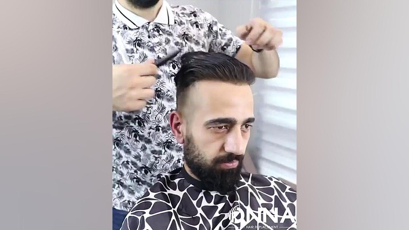 بهترین کلینیک پروتز مو در تهران جوانسازی پوست