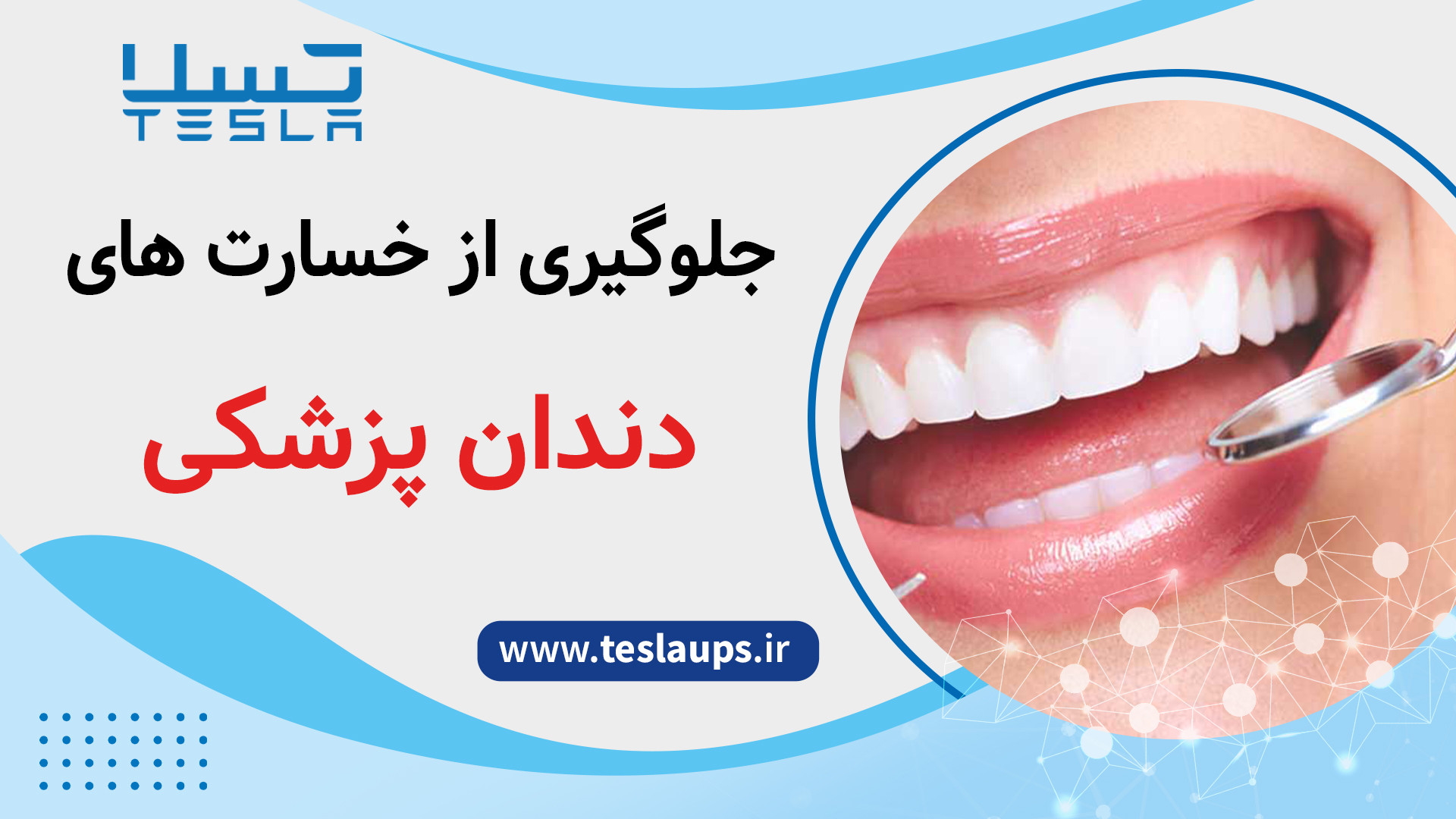 برای مطب دندان پزشکی یو پی اس خوبه یا استابلایزر بررسی سطح اسید لاکتیک خون