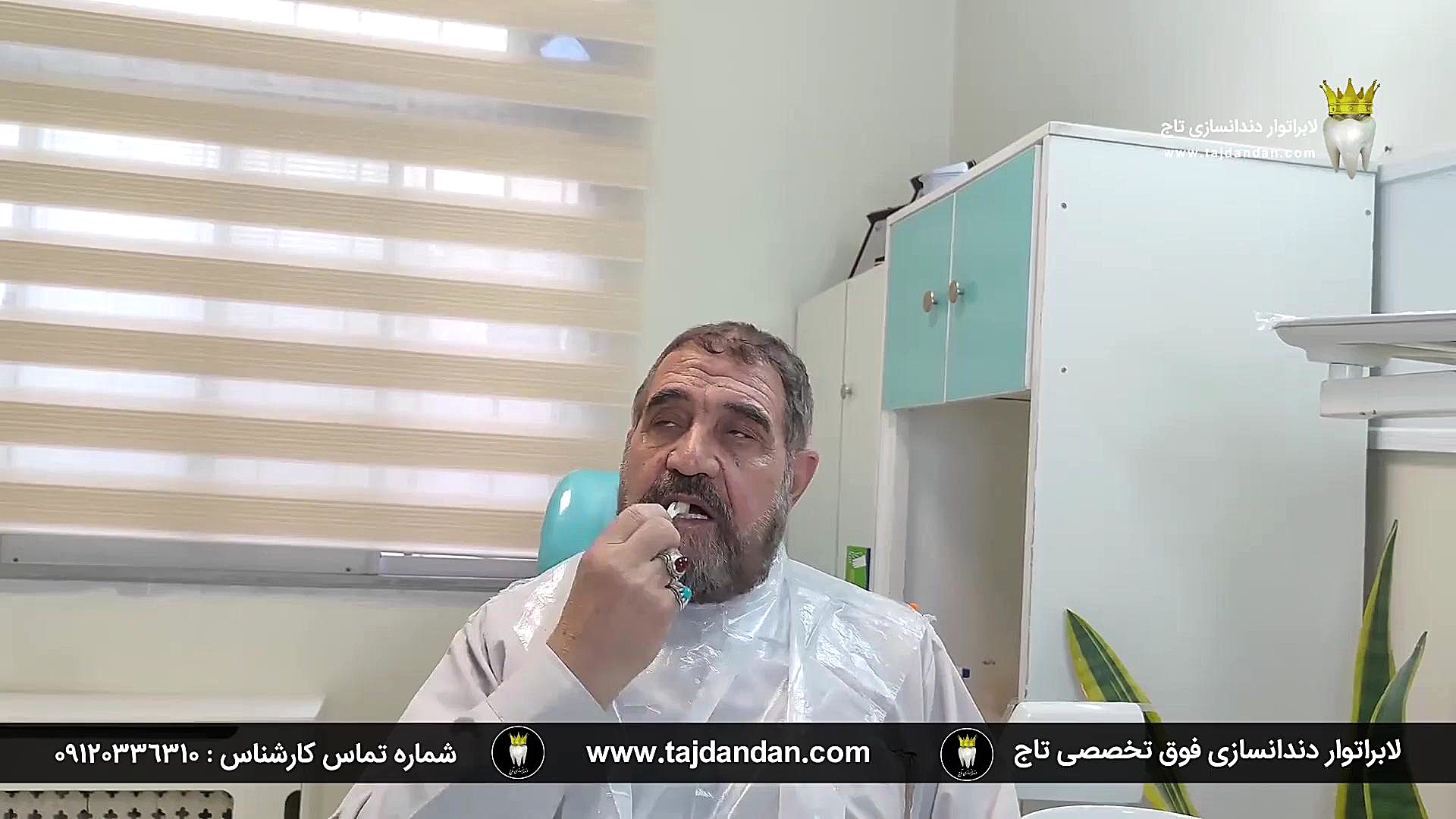 رضایت بیمار اهل کرج با تحلیل لثه شدید از ساخت پروتز دندان ایووبیس سوئیسی دندانپزشک زیبایی
