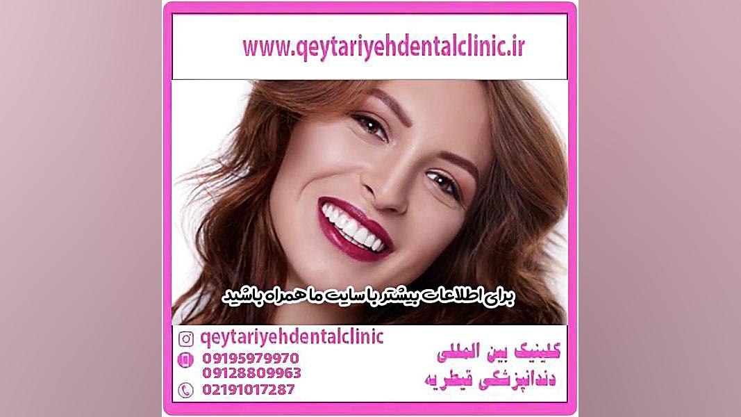 روکش دندان زیرکونیا چیست؟ جم‌سیتابین