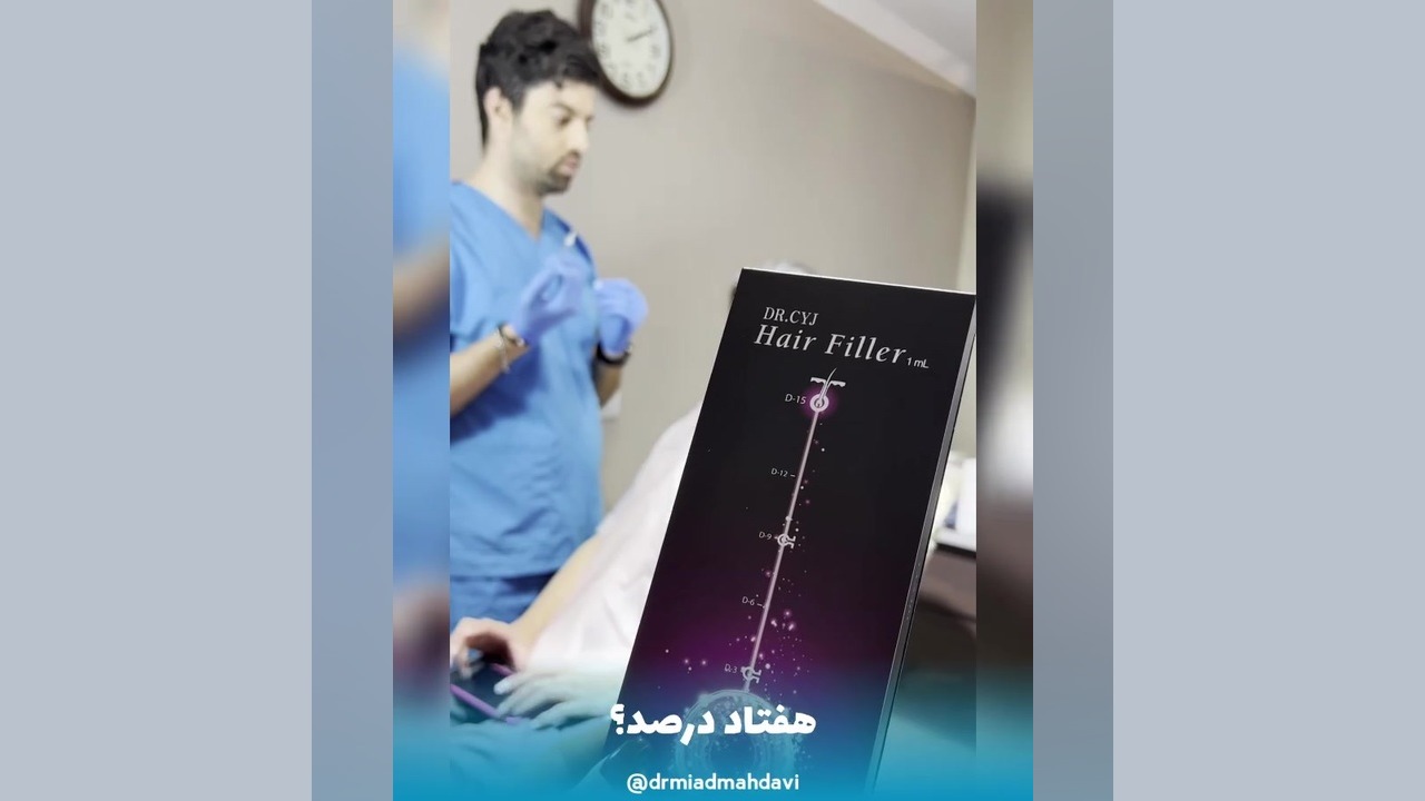 هیر فیلر | رضایت زیباجو از درمان ریزش مو | دکتر میعاد مهدوی کاپوت سکودانئوم