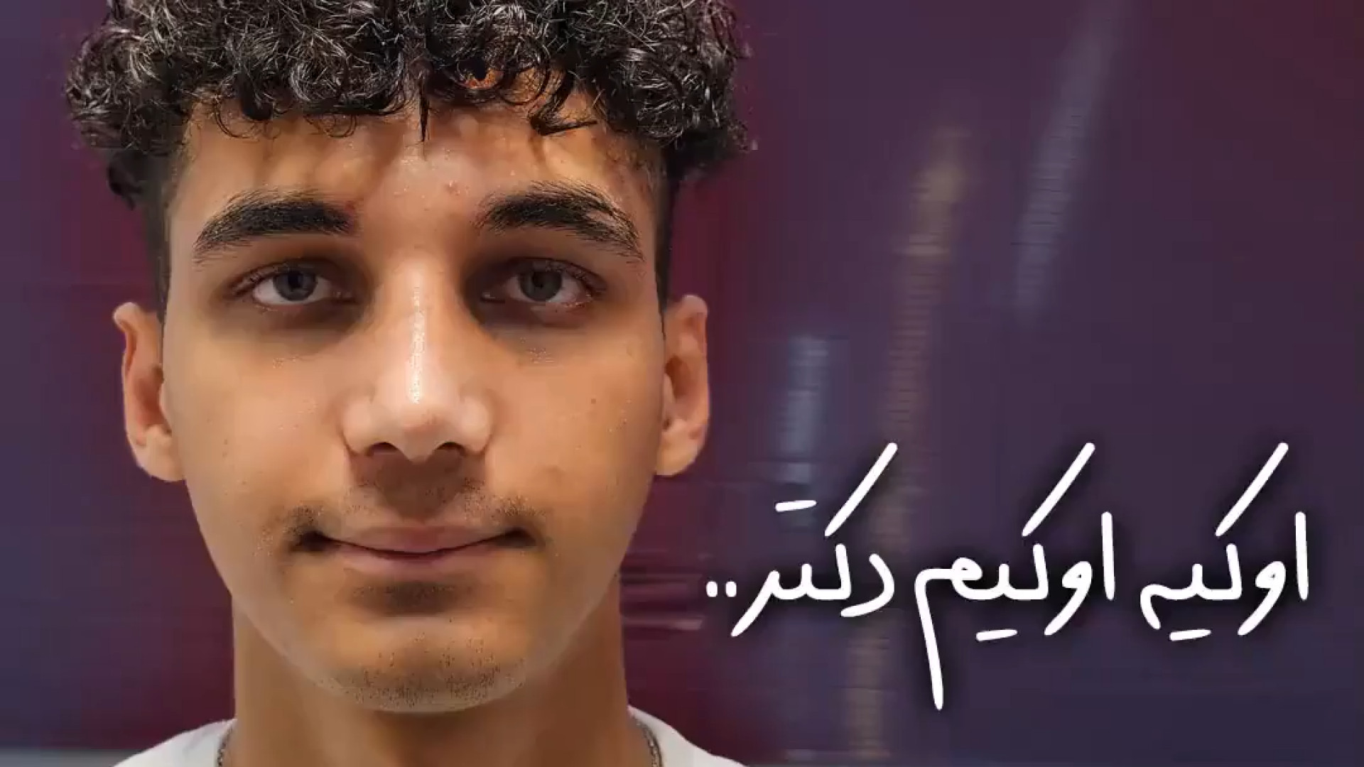 رفع انحراف بینی | دکتر علی واجاری دکتر علی حسینی واجاری - جراح بینی رشت
