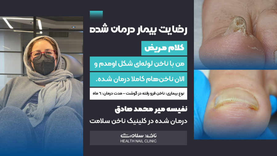 درمان ناخن فرو رفته در گوشت (کلینیک ناخن سلامت)