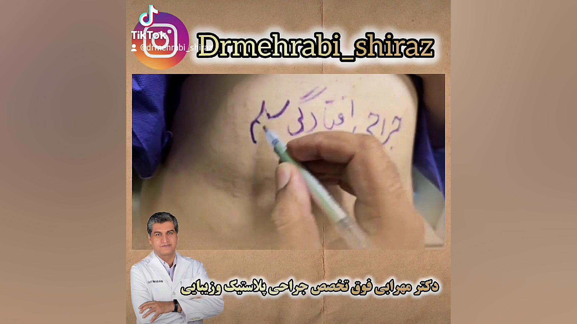 عمل افتادگی شکم لیفت شکم تزریق چربی باسن فیلم عمل شکم دکتر محمد مهدی مهرابی جراح پلاستیک و زیبایی