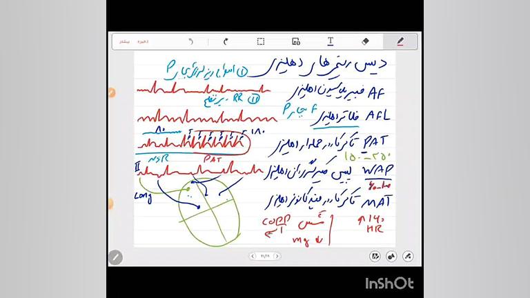 ECG لیفت پیشانی