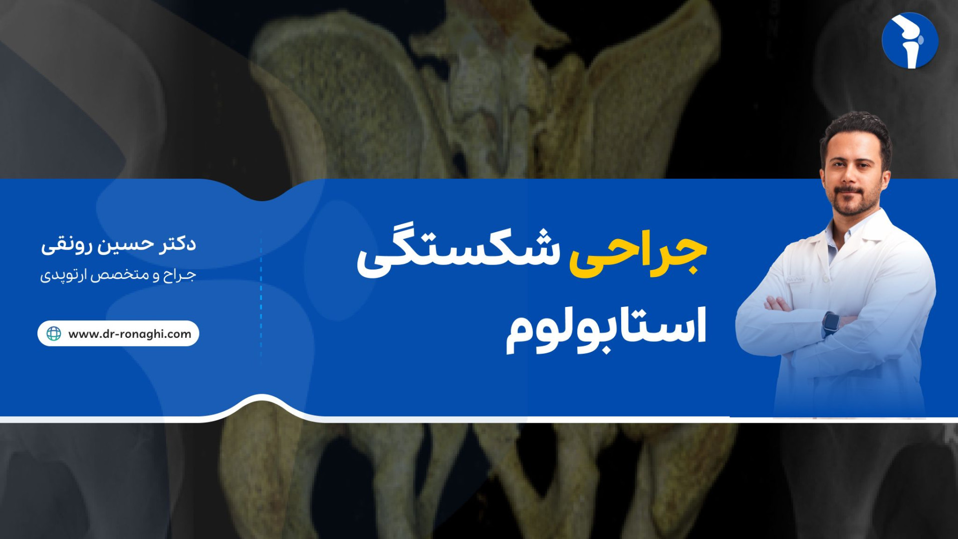 جراحی شکستگی استابولوم دکتر حسین‌رونقی متخصص ارتوپدی رشت لیلا حاتمی