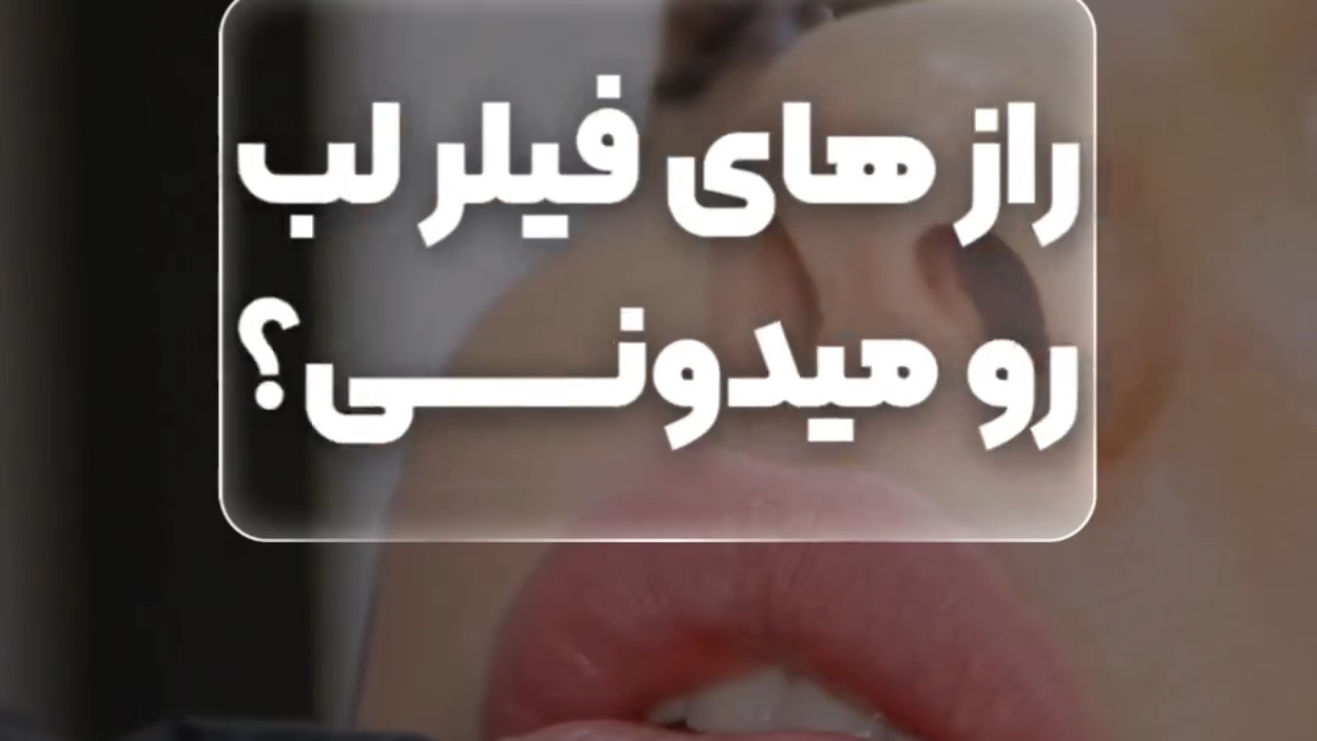 راز های فیلر لب دکتر امیر سلیمانی