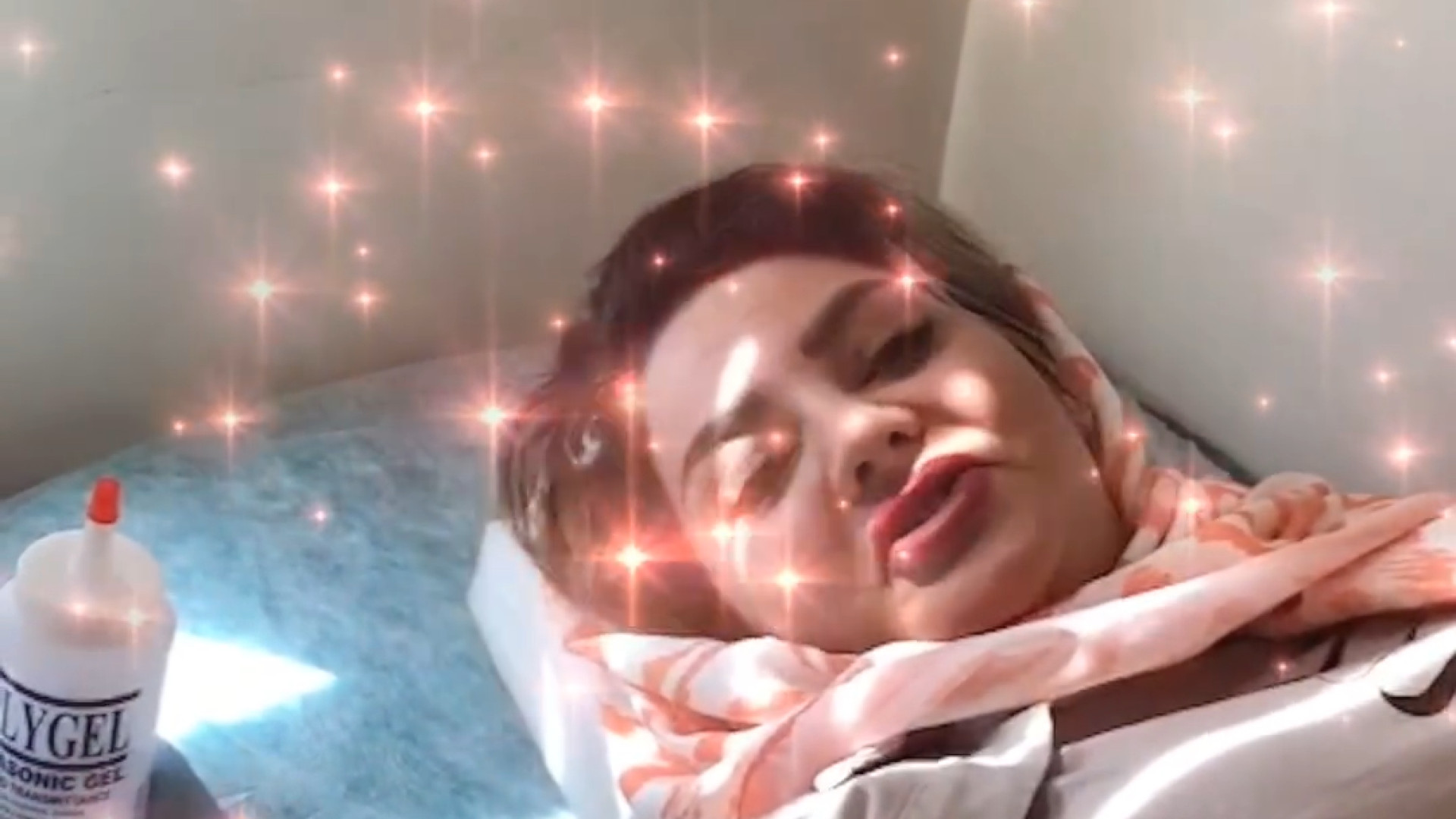 بارداری بعد از سقط و کیست تخمدان دکتر زهرا طالب زاده