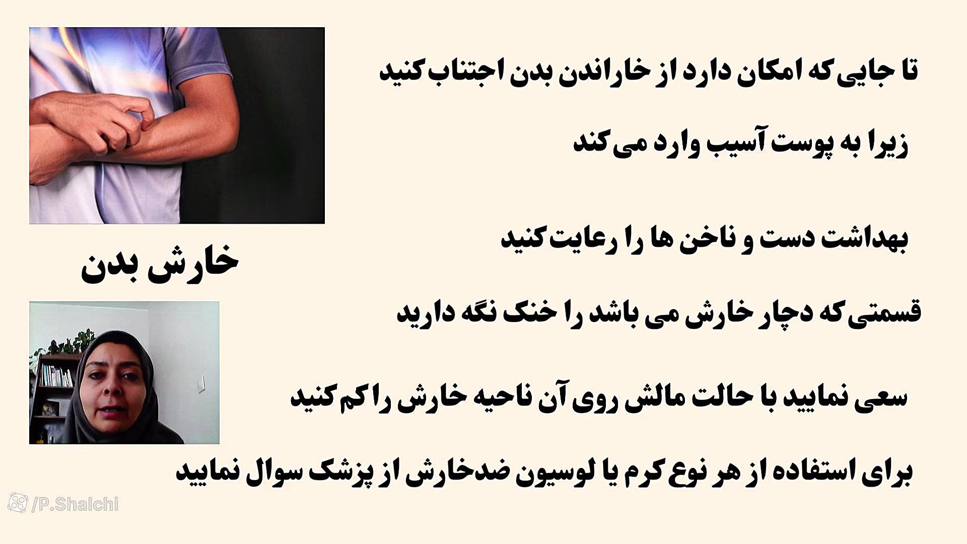 آشنایی با شیمی درمانی قسمت چهارم درمان ریزش مو