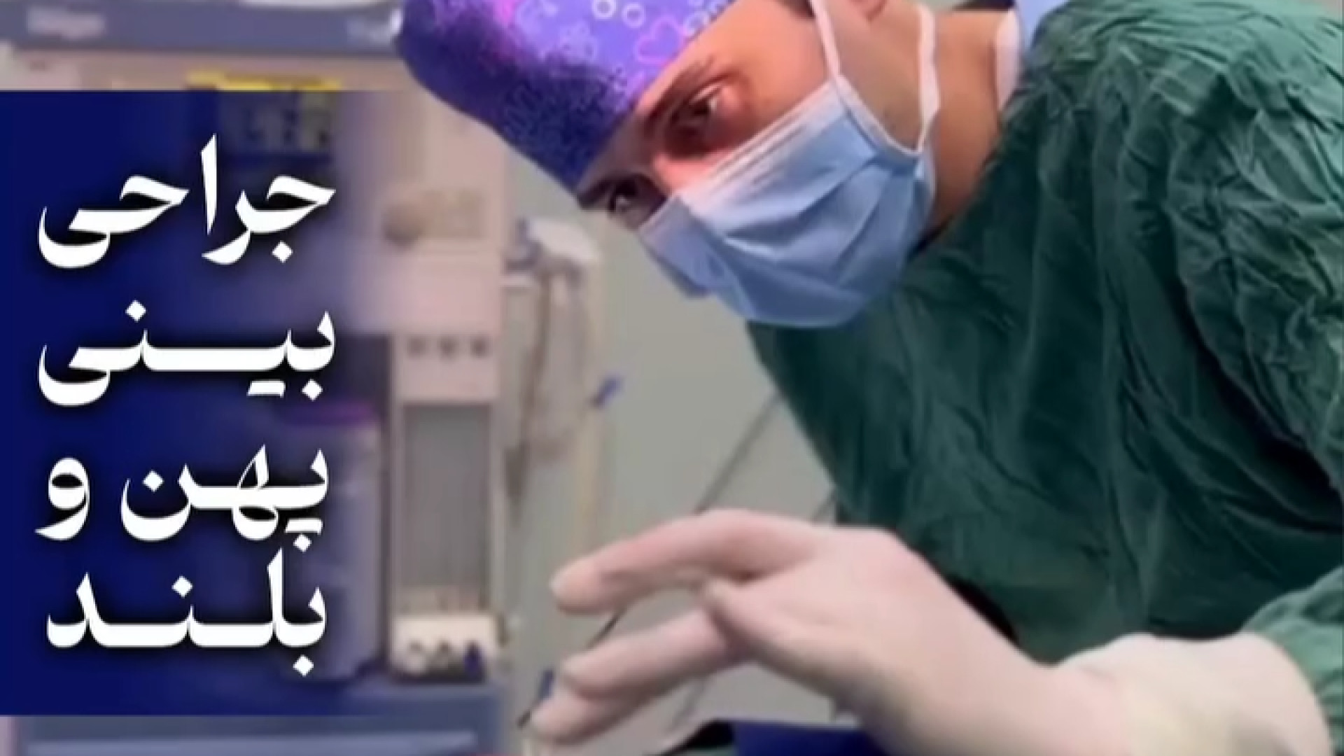 جراحی بینی پهن و بلند | دکتر علی واجاری دکتر علی حسینی واجاری - جراح بینی رشت