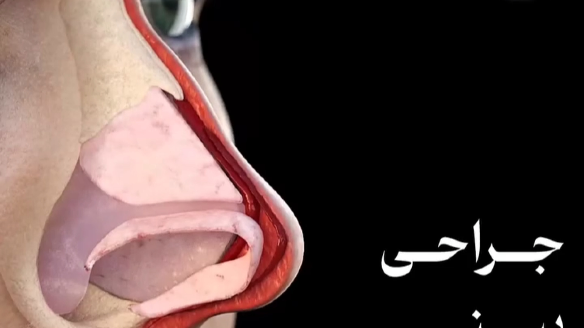 ویژگی های بینی استخوانی | دکتر علی واجاری دکتر علی حسینی واجاری - جراح بینی رشت