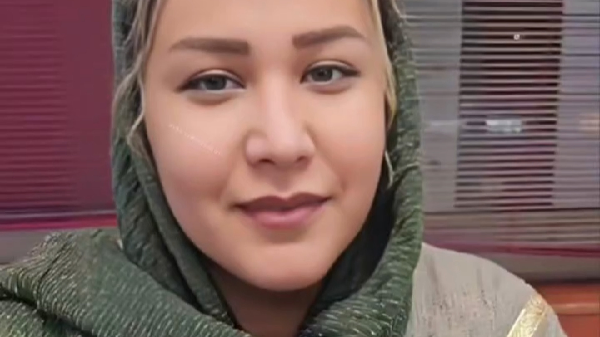 عمل بینی قوزدار و پهن | دکتر علی واجاری دکتر علی حسینی واجاری - جراح بینی رشت