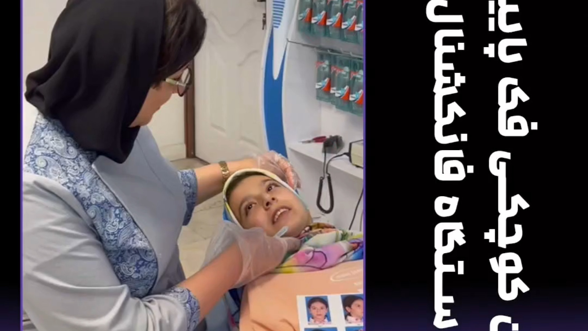 درمان کوچکی فک پایین با جدید ترین دستگاه فانکشنال دکتر ثریا یوسف نژاد متخصص ارتودنسی بابل