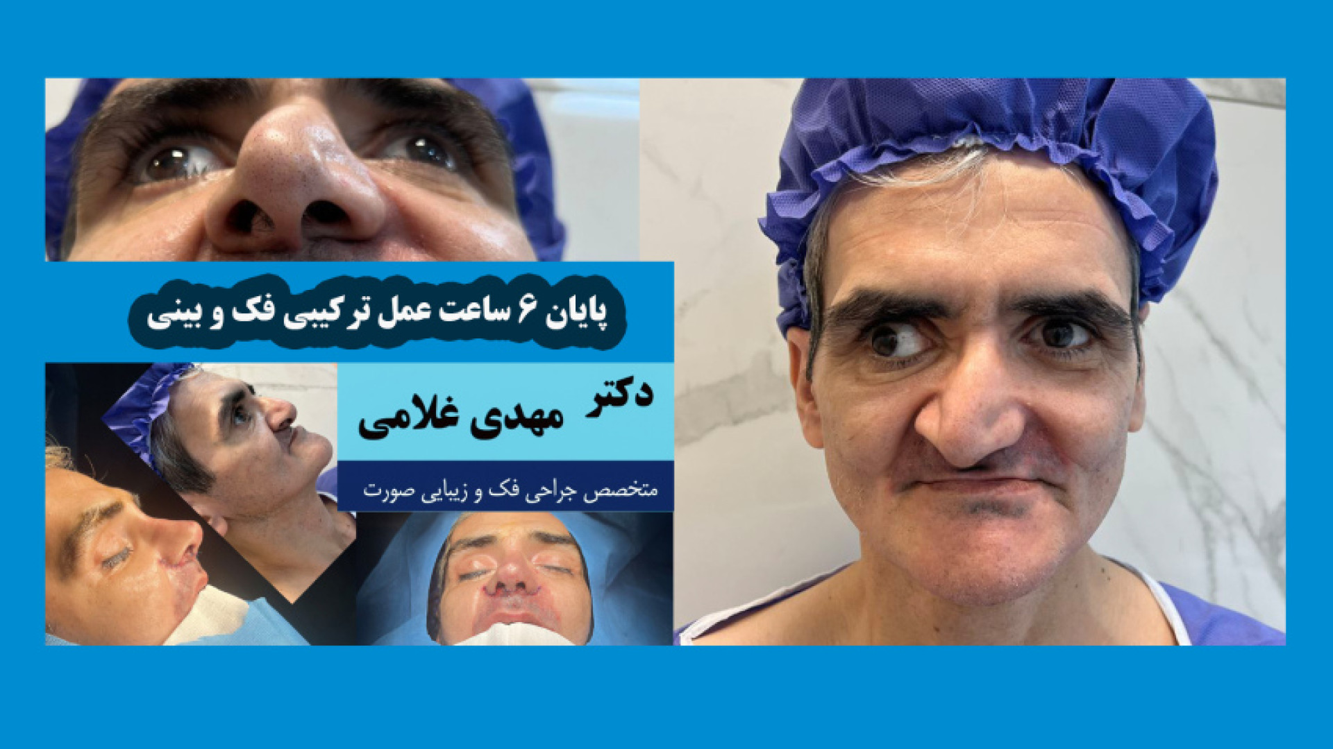 عمل ترکیبی فک و بینی دکتر مهدی غلامی مشهد دکتر مهدی غلامی