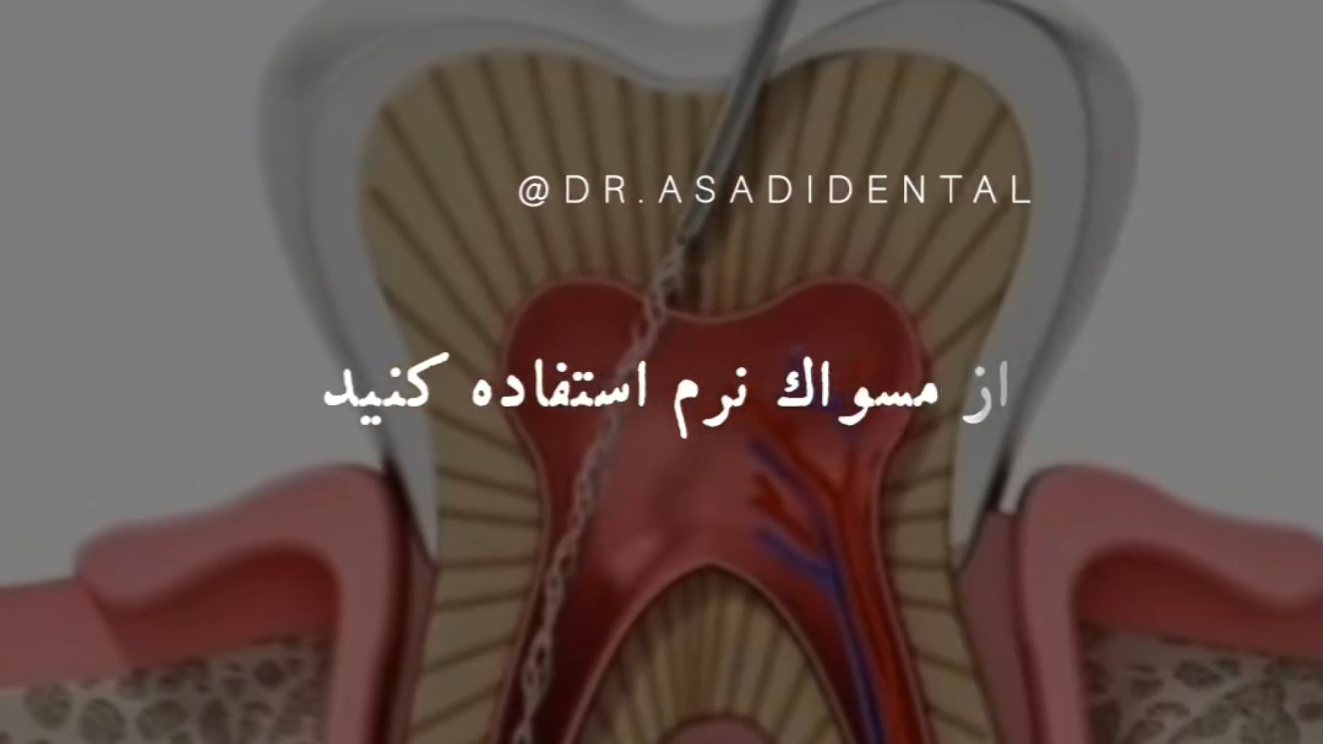 نکات بعد از عصب کشی Apoptosis Pathway Analysis