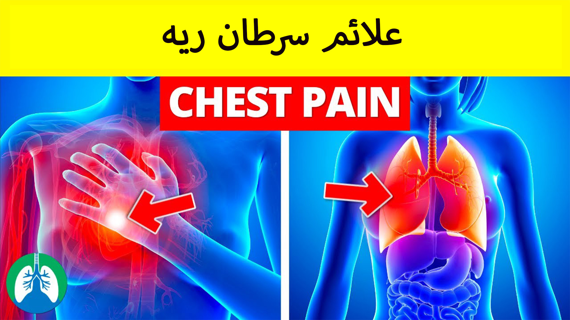 ارتباط درد قفسه و سرطان ریه/ علائم اولیه سرطان ریه و درمان آن ابرسانی پوست