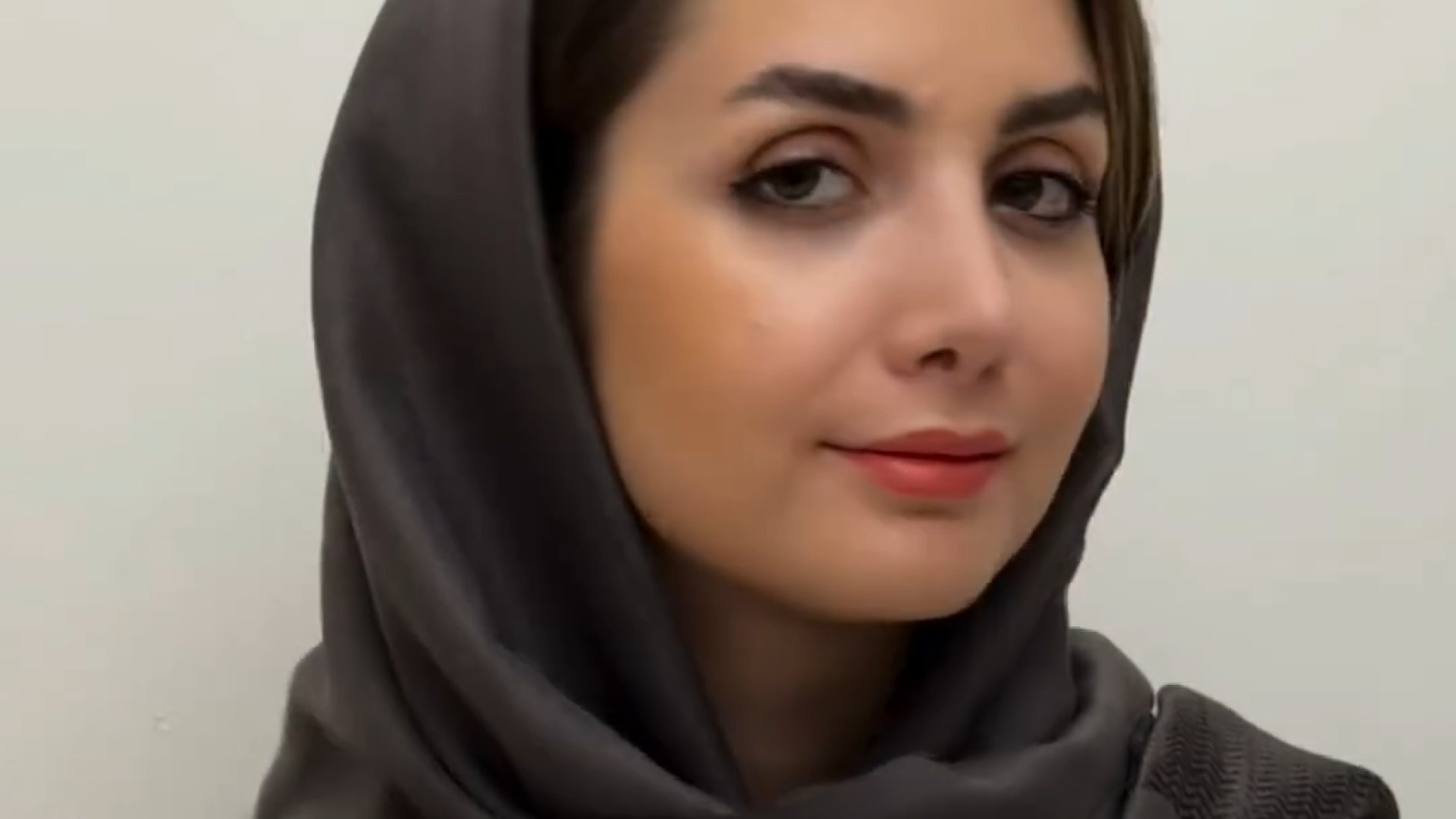 نتیجه عمل رینوپلاستی بعد از یک ماه | دکتر امین قانعی دکتر امین قانعی - جراح پلاستیک در اصفهان