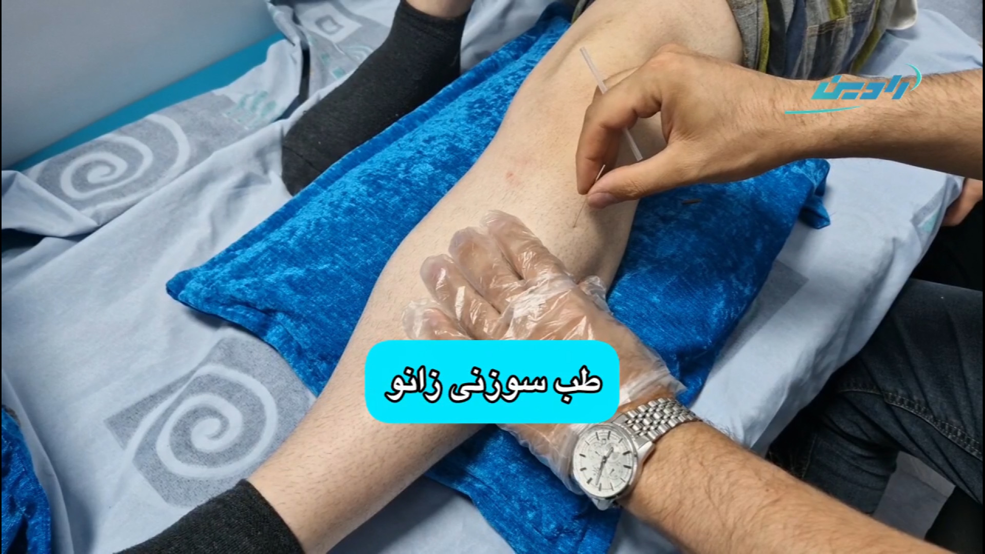 سوزن درمانی آرتروز زانو | فیزیوتراپی تخصصی رادین کلینیک دندانپزشکی