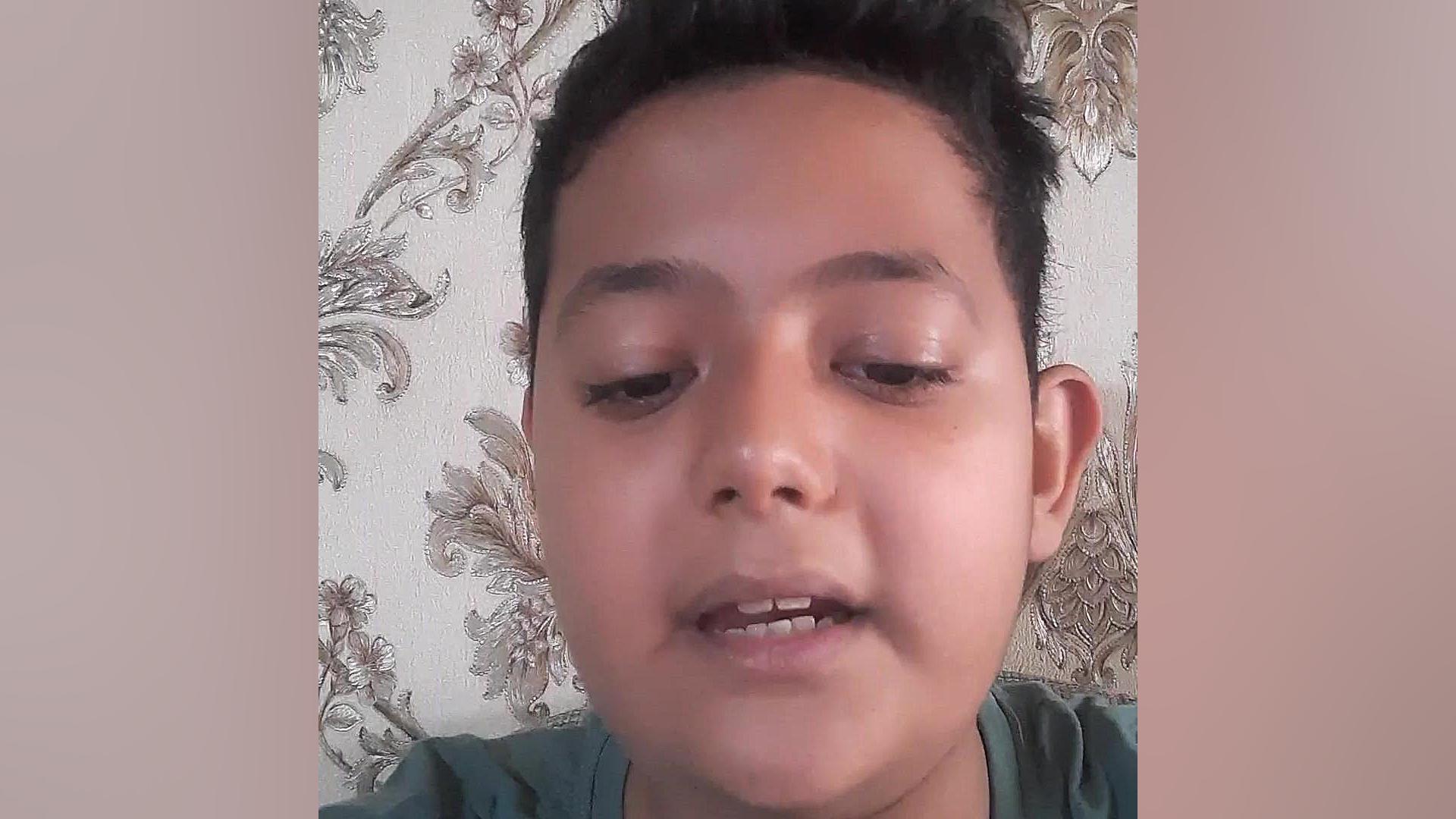 لام آپارات لیپوماتیک