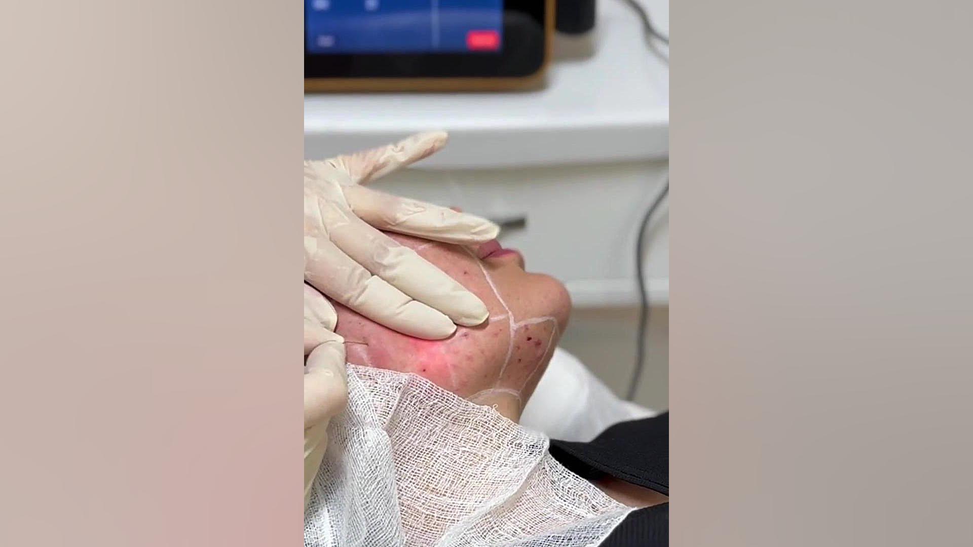 اندولیفت با دکتر آرش امانی فر لبرون جیمز