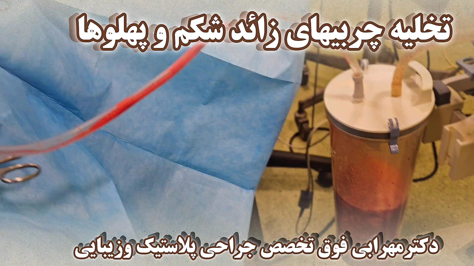 فیلم لیپوماتیک و پیکرتراشی در شیراز دکتر مهرابی فوق تخصص جراحی پلاستیک وزیبایی دکتر محمد مهدی مهرابی جراح پلاستیک و زیبایی