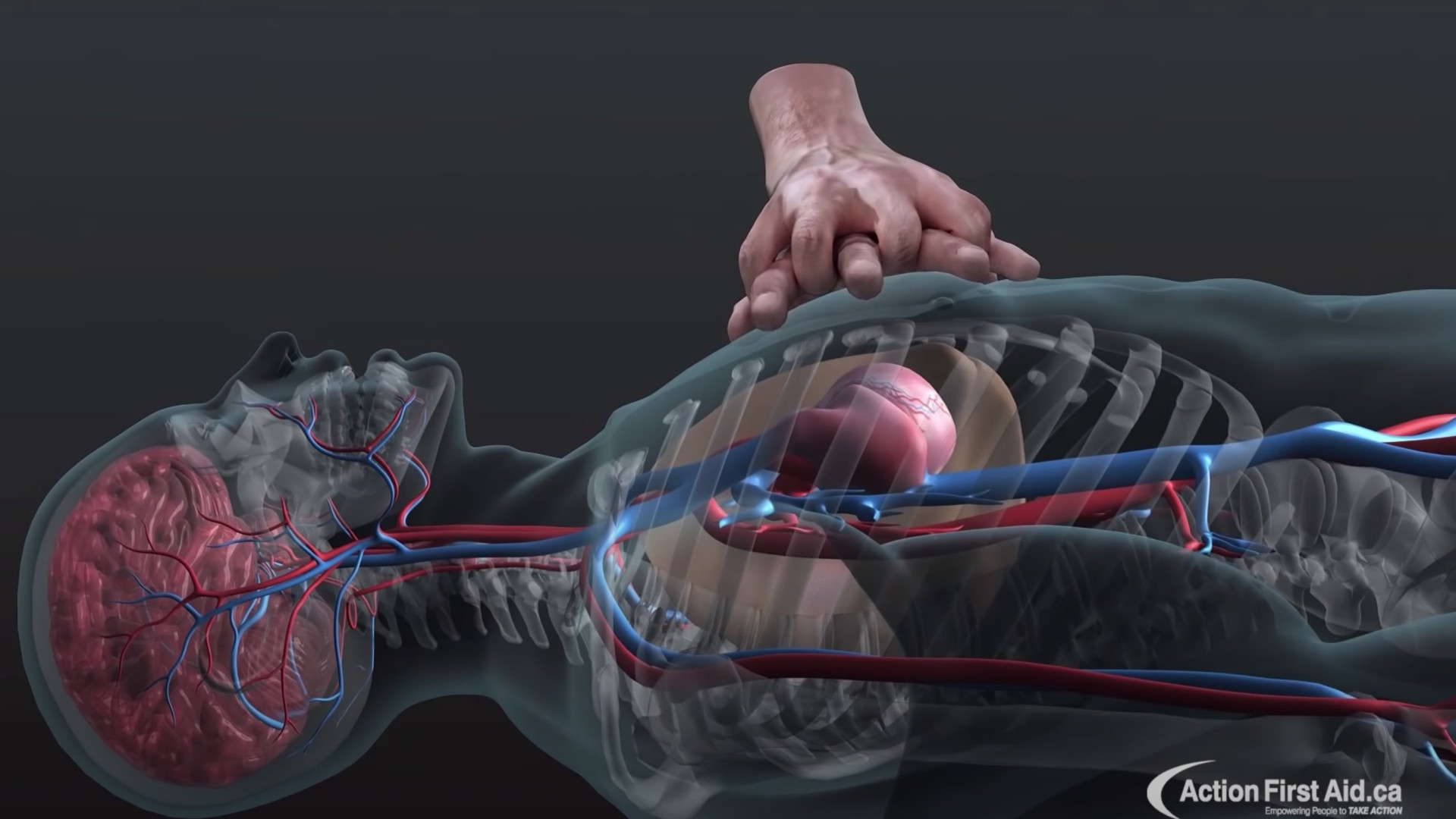 CPR چگونه قلب را احیا می کند ؟ لیفت ابرو