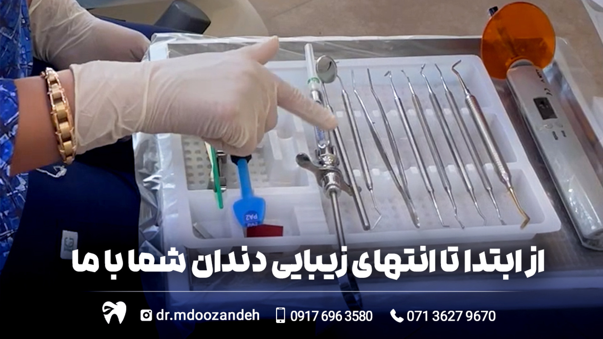 از ابتدا تا انتهای زیبایی دندان شما با ما مایکروگناتیا