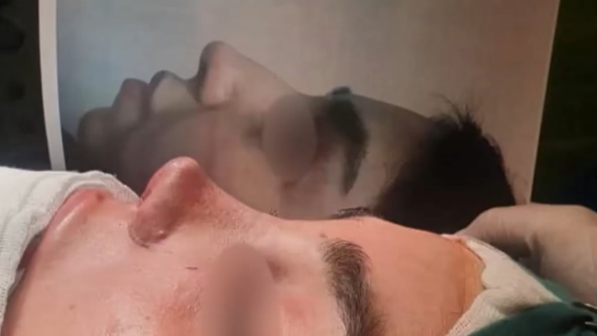 نتیجه عمل بینی دکتر محمودرضا اصحاب یمین - فوق تخصص پلاستیک